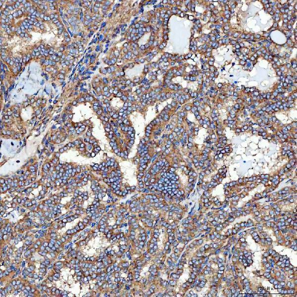 a09955 1 sec23ip primary antibodies ihc testing 12