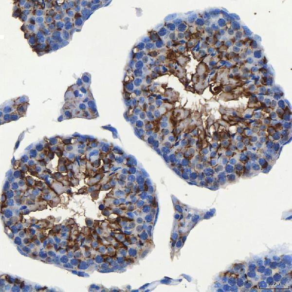 a09955 1 sec23ip primary antibodies ihc testing 13