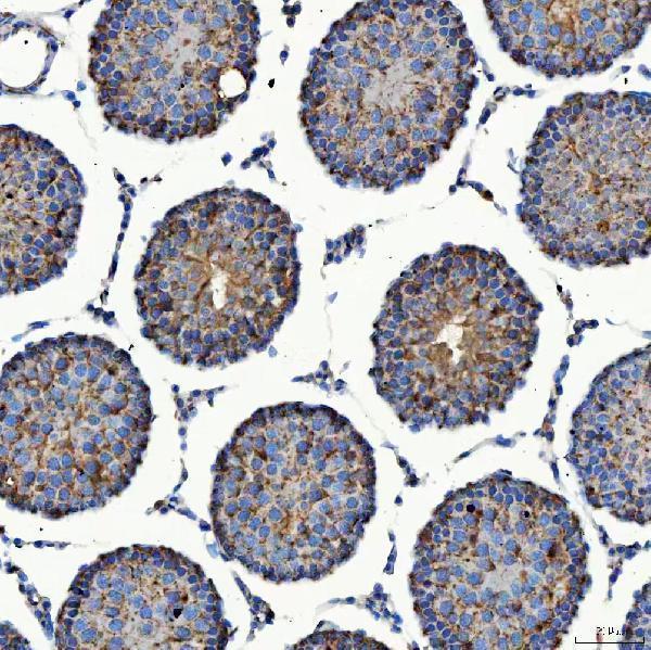 a09955 1 sec23ip primary antibodies ihc testing 14