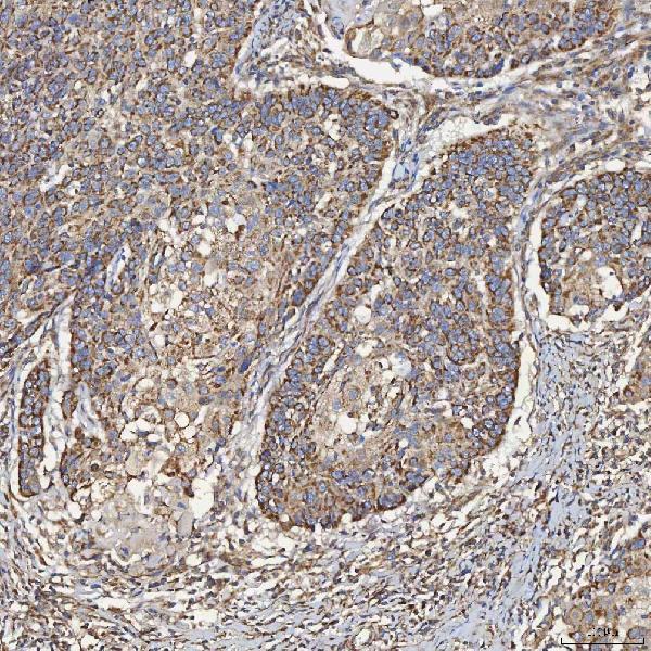  IHC analysis of SEC23IP using anti-SEC23IP antibody (A09955-1)