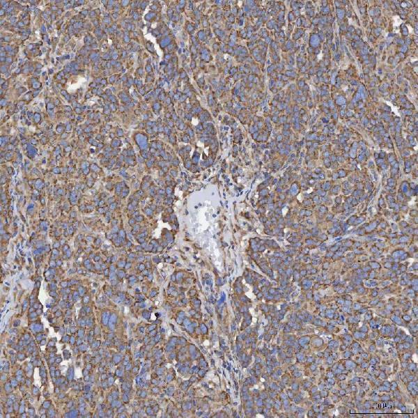 a09955 1 sec23ip primary antibodies ihc testing 4