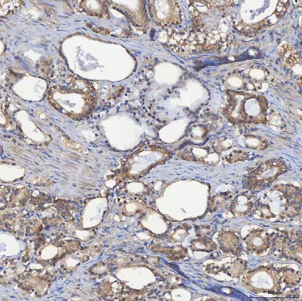 a09955 1 sec23ip primary antibodies ihc testing 5