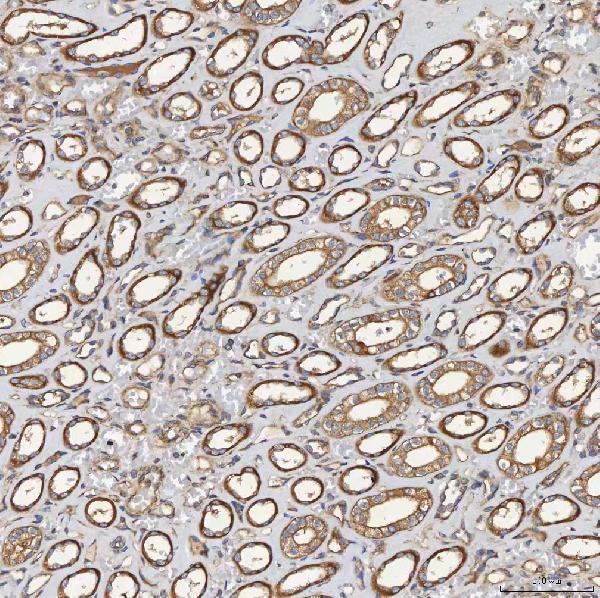a09955 1 sec23ip primary antibodies ihc testing 6
