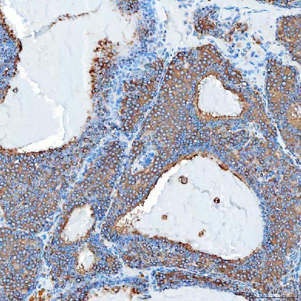 a09955 1 sec23ip primary antibodies ihc testing 7
