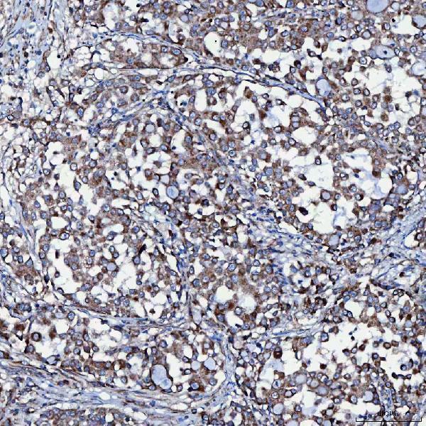 a09955 1 sec23ip primary antibodies ihc testing 9