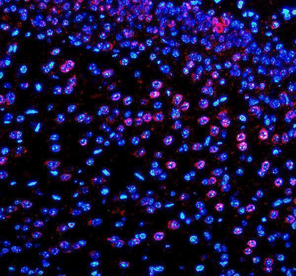 a09961 1 phf23 primary antibodies if testing 1