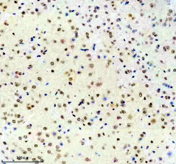 IHC analysis of PHF23 using anti-PHF23 antibody (A09961-1)