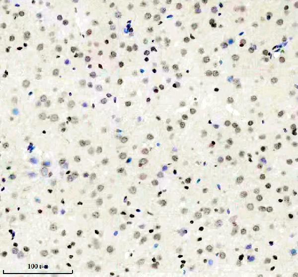a09961 1 phf23 primary antibodies ihc testing 3