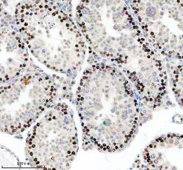 IHC analysis of RP9 using anti-RP9 antibody (A09964-1)
