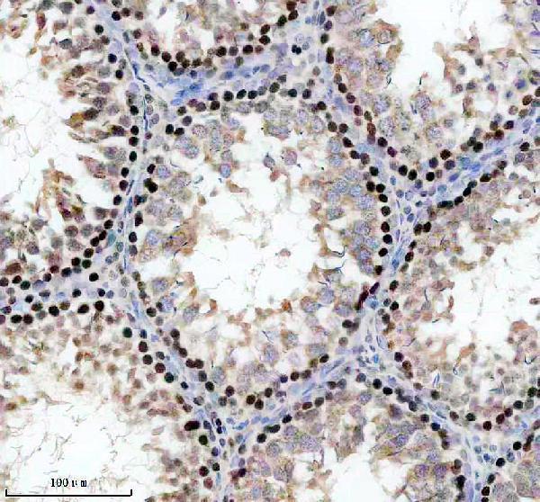 IHC analysis of RP9 using anti-RP9 antibody (A09964-1)