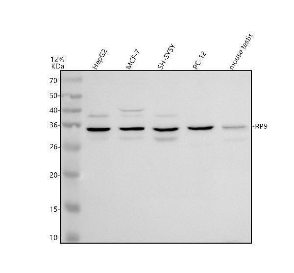 Western blot analysis of RP9 using anti-RP9 antibody (A09964-1)
