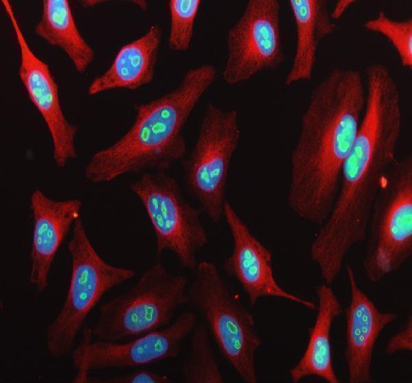a09966 1 ebna1bp2 primary antibodies if testing 1