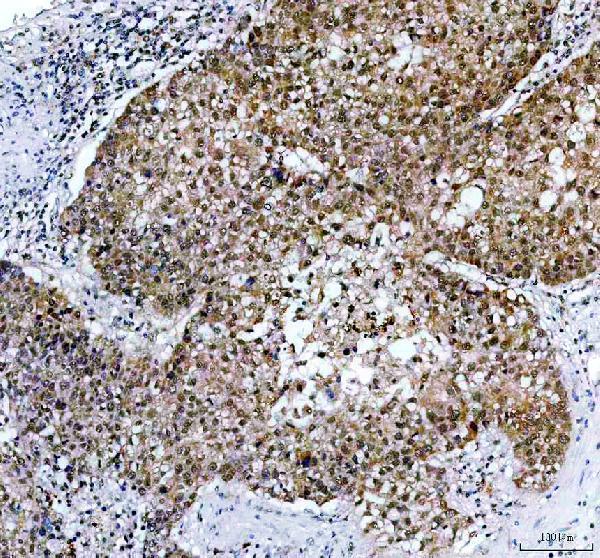 IHC analysis of EBP2/EBNA1BP2 using anti-EBP2/EBNA1BP2 antibody (A09966-1)