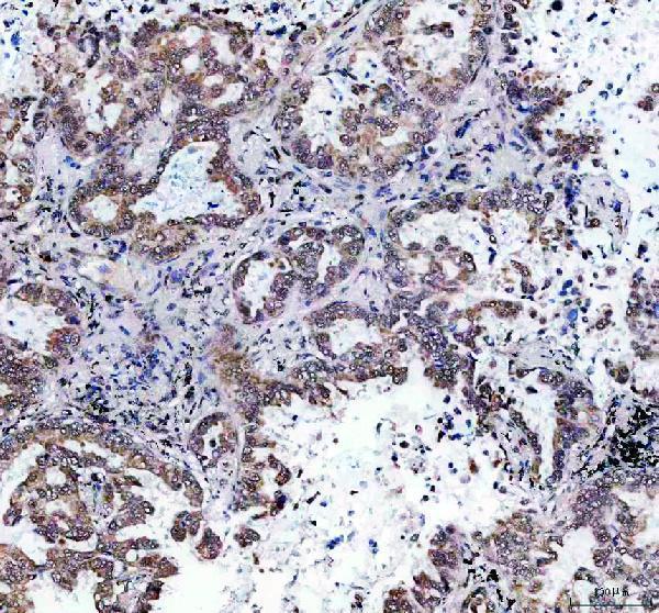 IHC analysis of EBP2/EBNA1BP2 using anti-EBP2/EBNA1BP2 antibody (A09966-1)