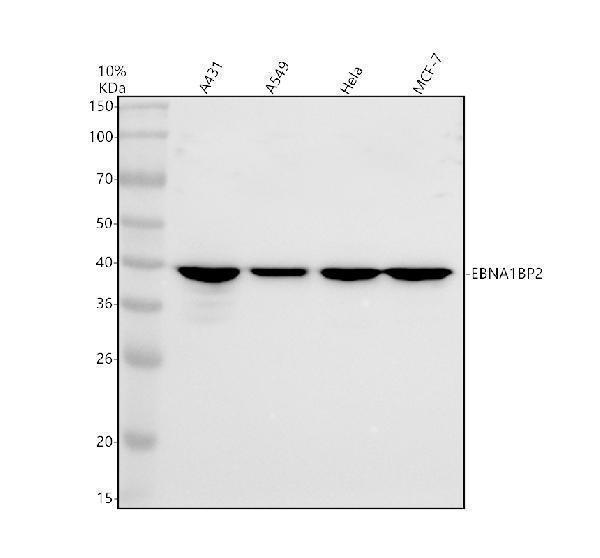 Western blot analysis of EBP2/EBNA1BP2 using anti-EBP2/EBNA1BP2 antibody (A09966-1)
