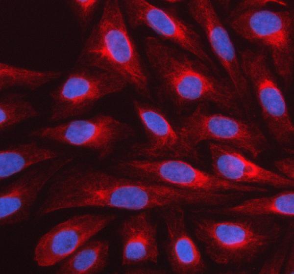 a09972 1 myh13 primary antibodies if testing 1