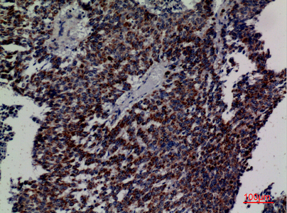 a09974 eci1 primary antibodyes ihc testing 2
