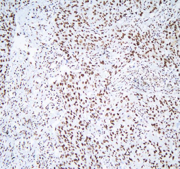a09982 1 hnrnpd primary antibodies ihc testing 4