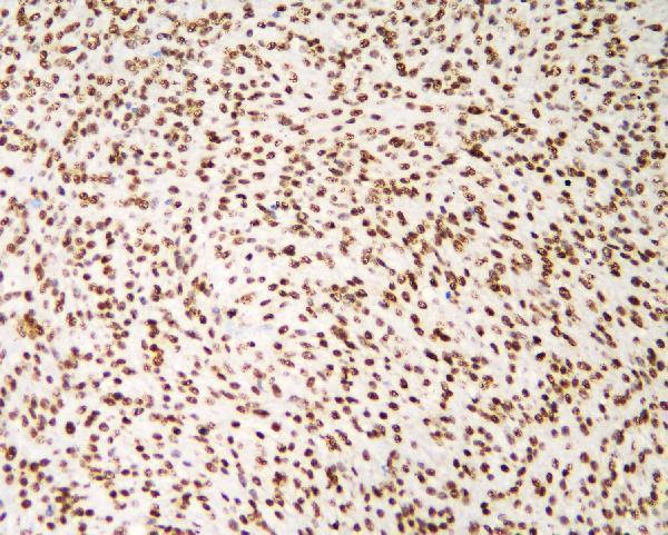 a09982 1 hnrnpd primary antibodies ihc testing 5