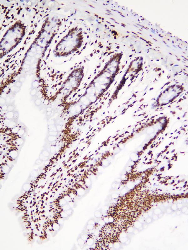 a09982 1 hnrnpd primary antibodies ihc testing 6