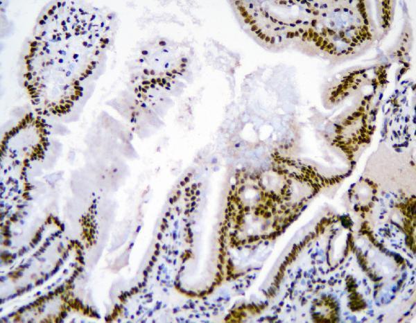 a09982 1 hnrnpd_ primary antibodies ihc testing 10
