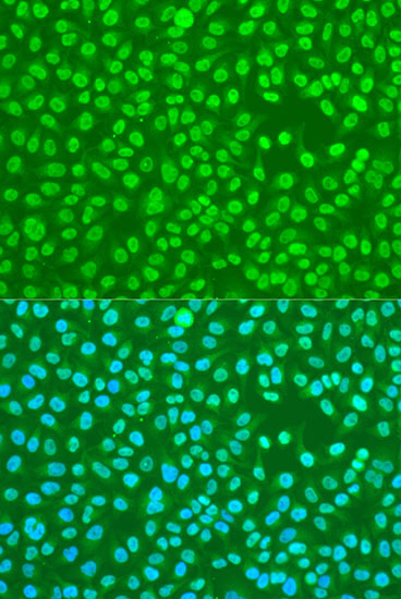 Immunofluorescence analysis of U2OS cells using HNRNPDL antibody  at dilution of 1:100