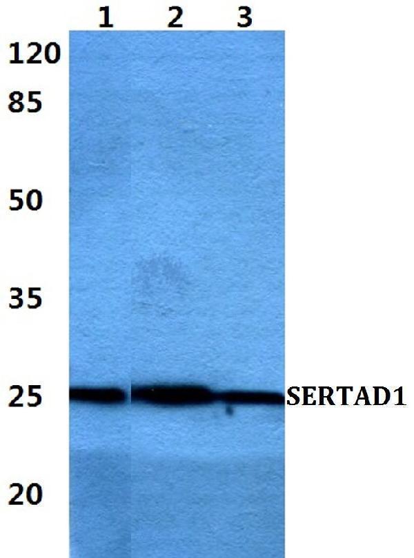 a09983 sertad1 primary antiboties wb testing 1