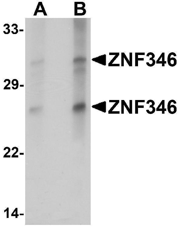 Western blot analysis of ZNF346 in human kidney tissue lysate with ZNF346 antibody at (A) 1 and (B) 2 μg/mL