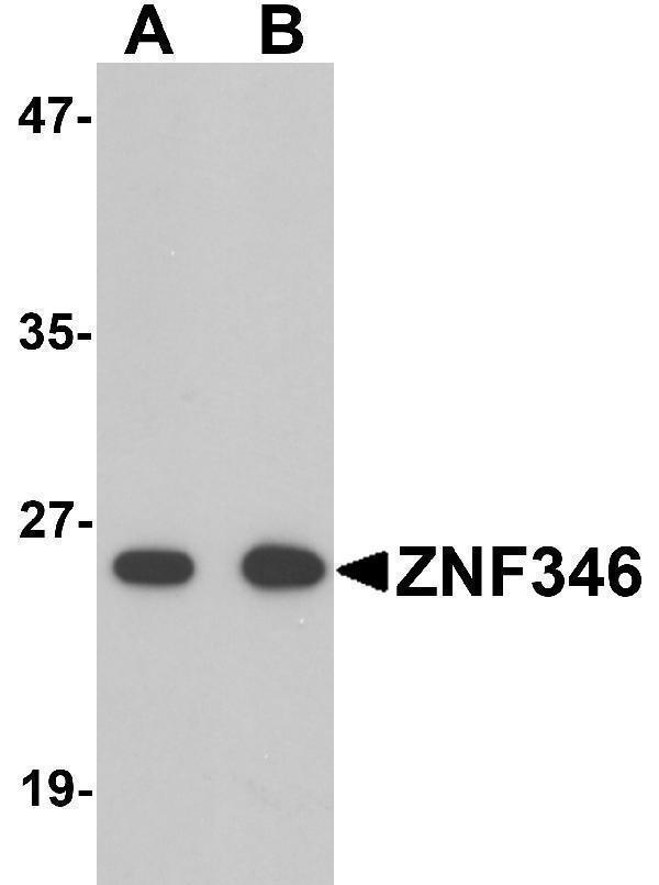 Western blot analysis of ZNF346 in human kidney tissue lysate with ZNF346 antibody (A) 0