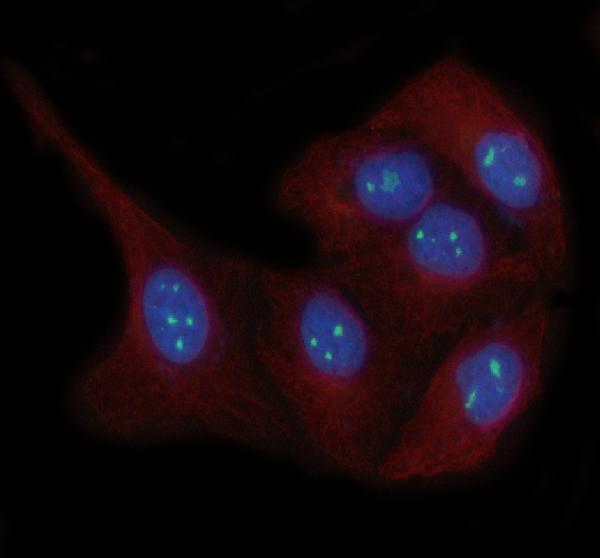  IF analysis of LYAR using anti-LYAR antibody (A09986-2) and anti-Beta Tubulin antibody (M01857-3)