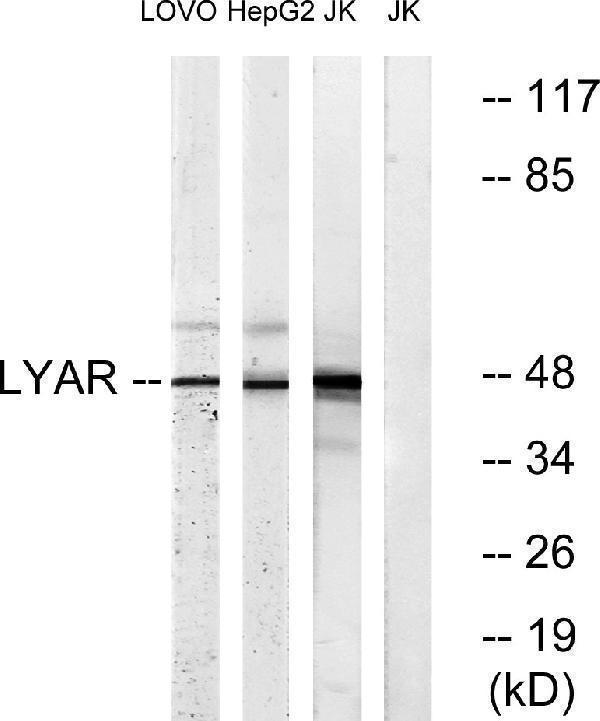 Western blot analysis of lysates from Jurkat, HepG2, and LOVO cells, using LYAR Antibody