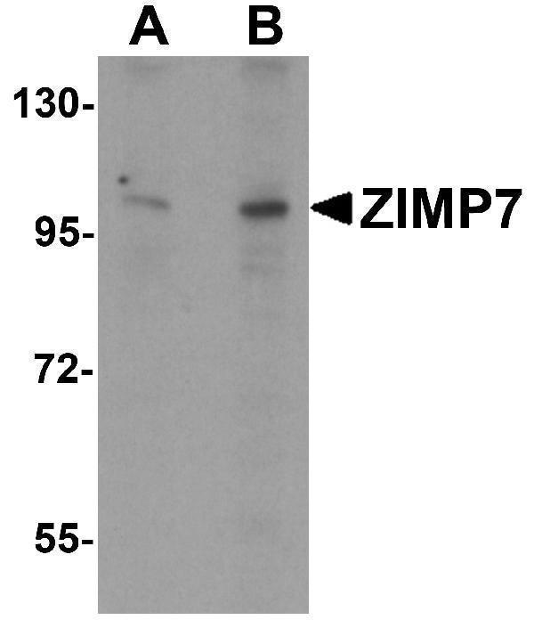 Western blot analysis of ZIMP7 in A20 cell lysate with ZIMP7 antibody at (A) 0