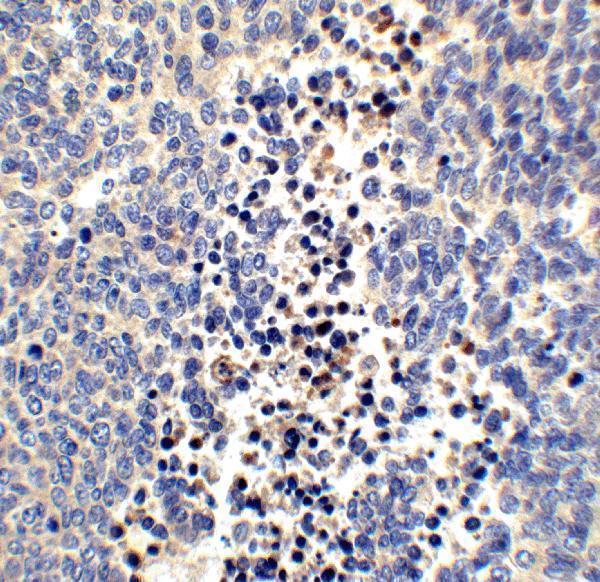 a09989 nrn1 primary antibodies ihc testing 4
