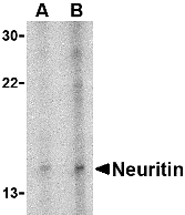 Western blot analysis of neuritin in Daudi cell lysate with neuritin antibody at (A) 5 and (B) 10 μg/mL