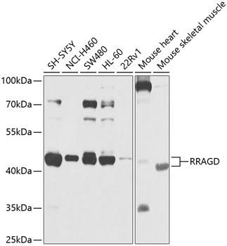 Western blot analysis of extracts of various cell lines, using RRAGD antibody  at 1:1000 dilution