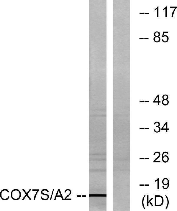Western blot analysis of lysates from rat heart cells, using COX7S/A2 Antibody