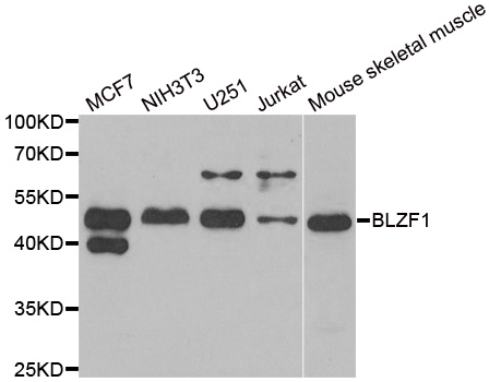 a09997 2 blzf1 primary antiboties wb testing 1