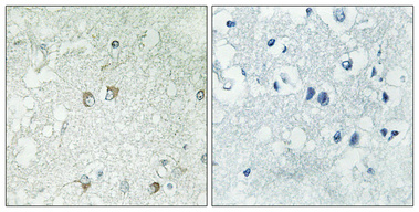 Immunohistochemical analysis of paraffin-embedded Human brain