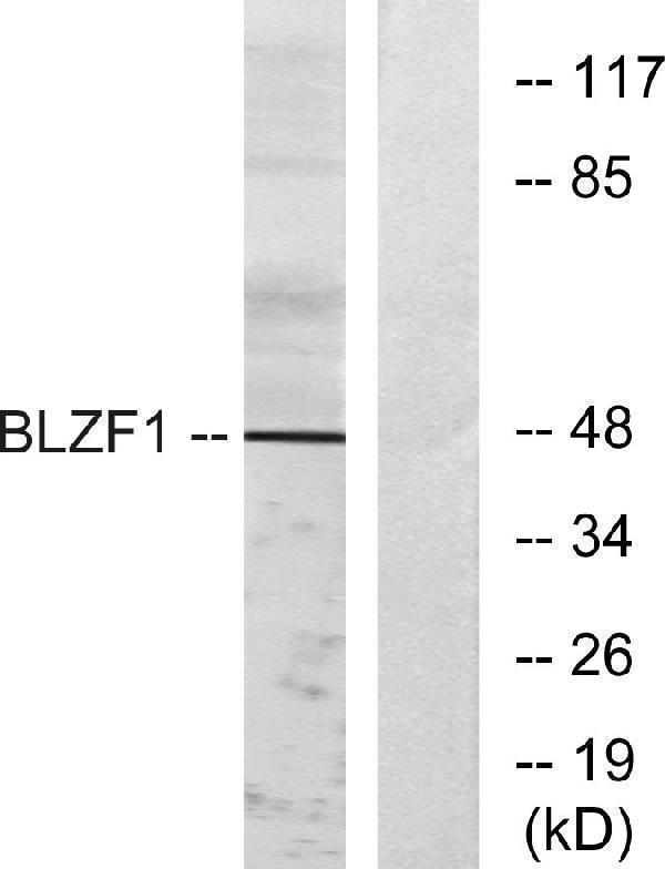 Western blot analysis of lysates from Jurkat cells, using BLZF1 Antibody