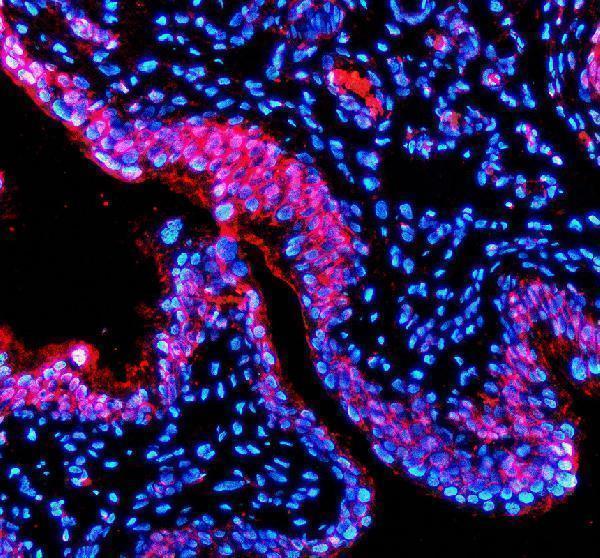 a10000 1 pdcl3 primary antibodies if testing 1