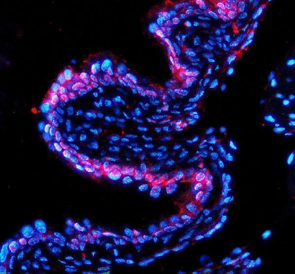a10000 1 pdcl3 primary antibodies if testing 2