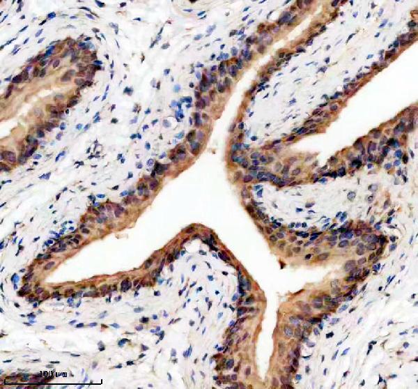 a10000 1 pdcl3 primary antibodies ihc testing 1