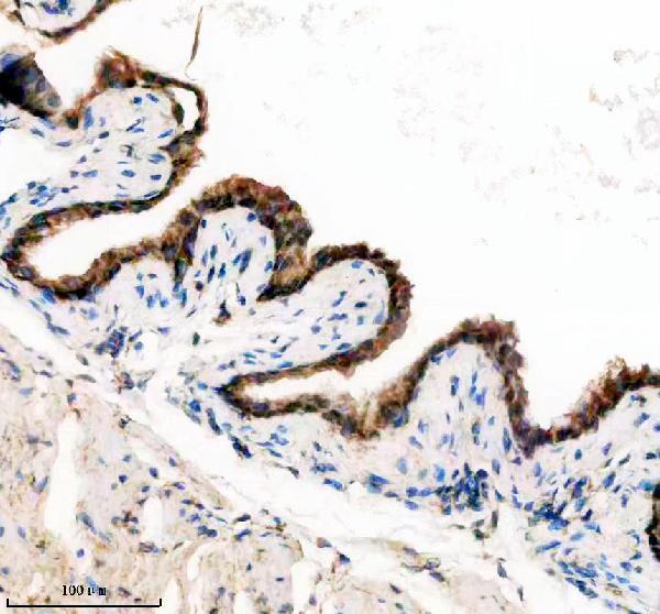 a10000 1 pdcl3 primary antibodies ihc testing 2