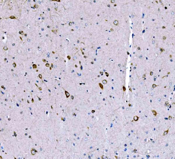 Figure 7. IHC analysis of SCRN1 using anti-SCRN1 antibody (A10002-1). SCRN1 was detected in a paraffin-embedded section of rat brain tissue. Heat mediated antigen retrieval was performed in EDTA buffer (pH 8.0, epitope retrieval solution). The tissue section was blocked with 10% goat serum. The tissue section was then incubated with 2 microg/ml rabbit anti-SCRN1 Antibody (A10002-1) overnight at 4°C. Biotinylated goat anti-rabbit IgG was used as secondary antibody and incubated for 30 minutes at 37°C. The tissue section was developed using Strepavidin-Biotin-Complex (SABC) (Catalog # SA1022) with DAB as the chromogen.