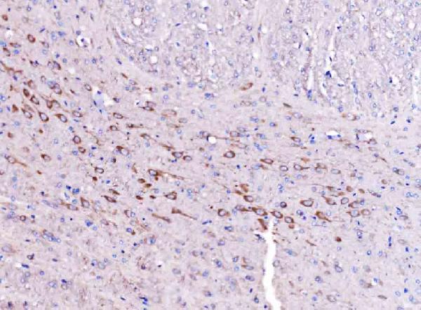 Figure 8. IHC analysis of SCRN1 using anti-SCRN1 antibody (A10002-1). SCRN1 was detected in a paraffin-embedded section of rat brain tissue. Heat mediated antigen retrieval was performed in EDTA buffer (pH 8.0, epitope retrieval solution). The tissue section was blocked with 10% goat serum. The tissue section was then incubated with 2 microg/ml rabbit anti-SCRN1 Antibody (A10002-1) overnight at 4°C. Biotinylated goat anti-rabbit IgG was used as secondary antibody and incubated for 30 minutes at 37°C. The tissue section was developed using Strepavidin-Biotin-Complex (SABC) (Catalog # SA1022) with DAB as the chromogen.