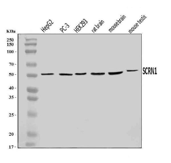 Figure 1. Western blot analysis of SCRN1 using anti-SCRN1 antibody (A10002-1). Electrophoresis was performed on a 5-20% SDS-PAGE gel at 70V (Stacking gel) / 90V (Resolving gel) for 2-3 hours. The sample well of each lane was loaded with 30 ug of sample under reducing conditions. Lane 1: human HepG2 whole cell lysates, Lane 2: human PC-3 whole cell lysates, Lane 3: human HEK293 whole cell lysates, Lane 4: rat brain tissue lysates, Lane 5: mouse brain tissue lysates, Lane 6: mouse testis tissue lysates. After electrophoresis, proteins were transferred to a nitrocellulose membrane at 150 mA for 50-90 minutes. Blocked the membrane with 5% non-fat milk/TBS for 1.5 hour at RT. The membrane was incubated with rabbit anti-SCRN1 antigen affinity purified polyclonal antibody (Catalog # A10002-1) at 0.25 microg/mL overnight at 4°C, then washed with TBS-0.1%Tween 3 times with 5 minutes each and probed with a goat anti-rabbit IgG-HRP secondary antibody at a dilution of 1:5000 for 1.5 hour at RT. The signal is developed using an Enhanced Chemiluminescent detection (ECL) kit (Catalog # EK1002) with Tanon 5200 system. A specific band was detected for SCRN1 at approximately 50 kDa. The expected band size for SCRN1 is at 50 kDa.
