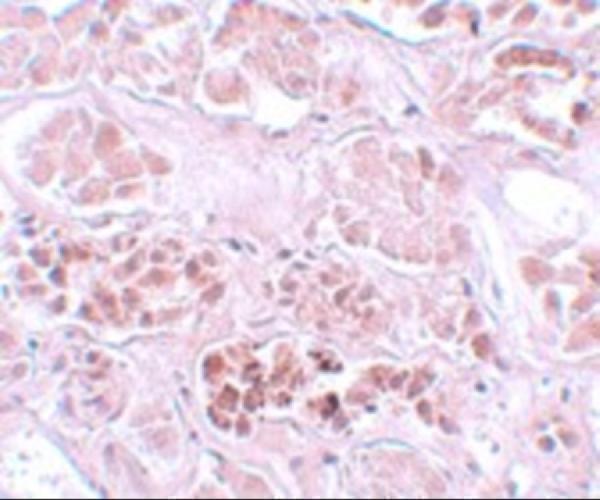 a10002 scrn1 primary antibodies ihc testing 2