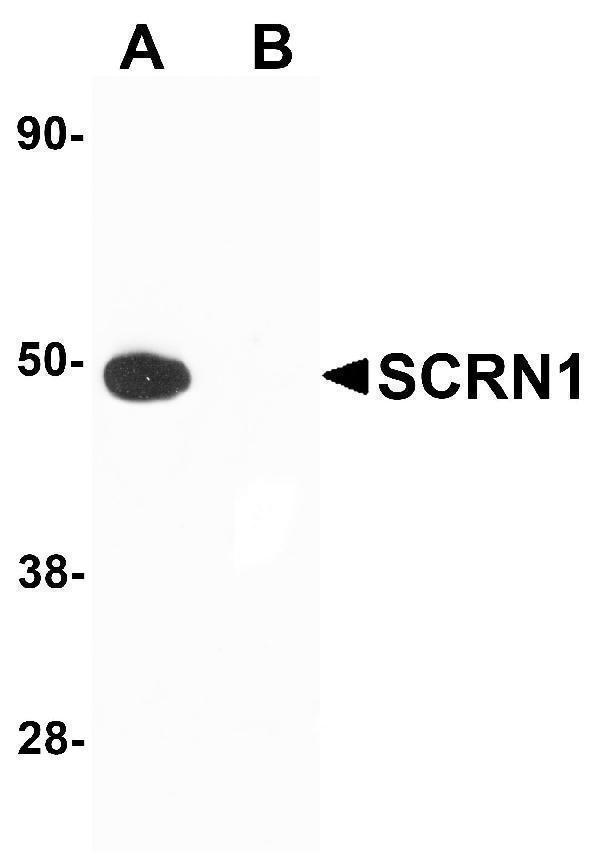 a10002 scrn1 primary antibodies wb testing 1