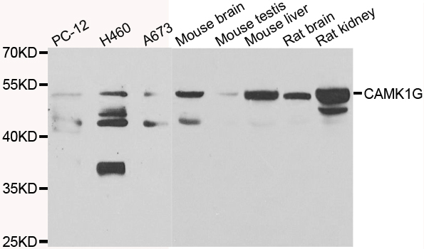 Western blot analysis of extracts of various cell lines, using CAMK1G antibody