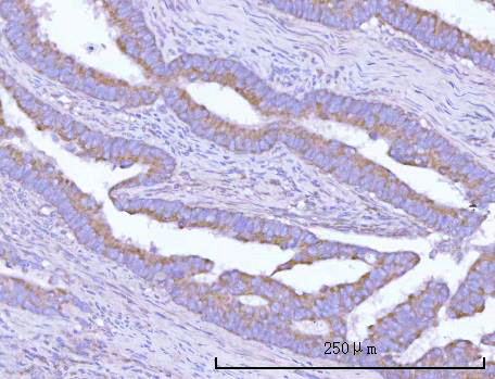 a10009 1 osgin1 primary antibodies ihc testing 2